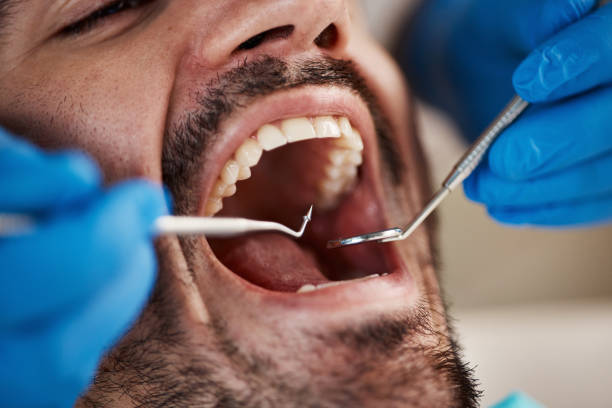 Best Pediatric Emergency Dentist in Winnsboro, LA