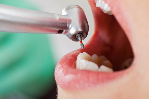 Best After-Hours Emergency Dentist in Winnsboro, LA